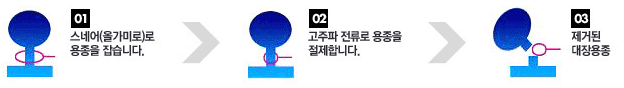 내시경적 용종 절제술