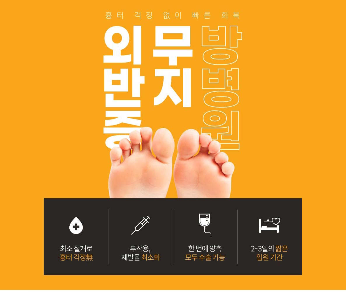 무지외반증