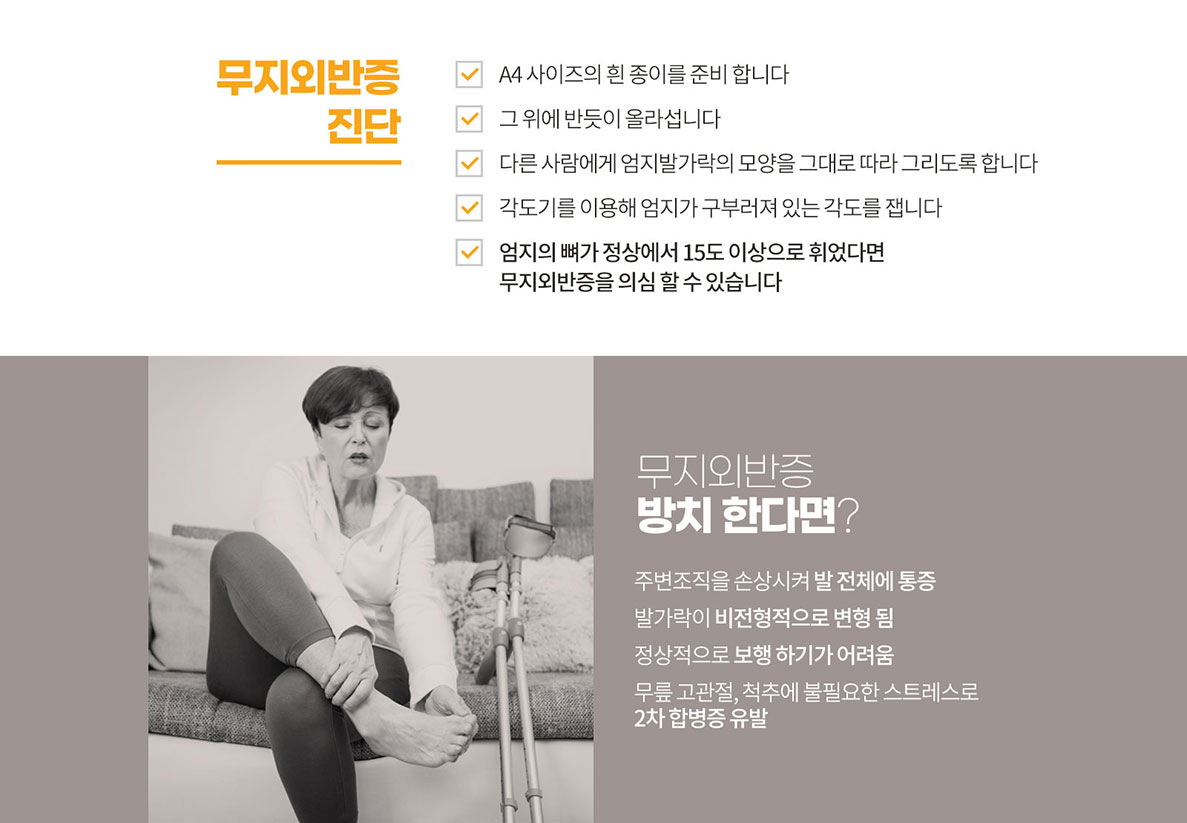 무지외반증
