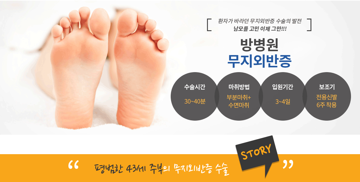 무지외반증